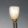 Palatal Cross Screw Implant angulation