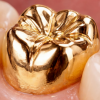 FULL METAL CROWN