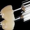 IMPLANT 