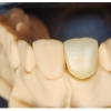 High translucent zirconia after sintering 