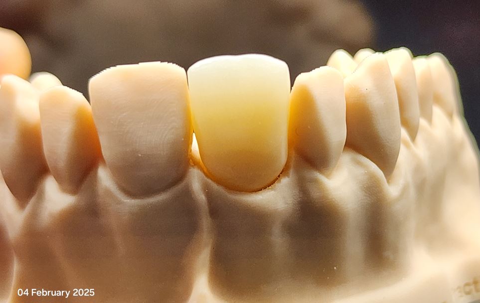 High translucent zirconia (without stain & glaze)