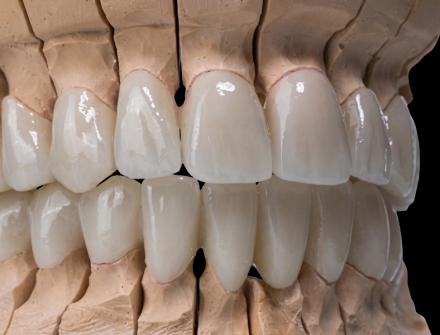 ZIRCONIA