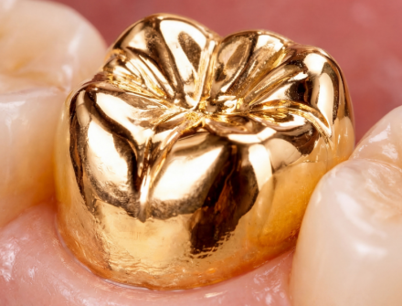 FULL METAL CROWN