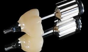 IMPLANT 