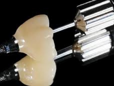 IMPLANT 