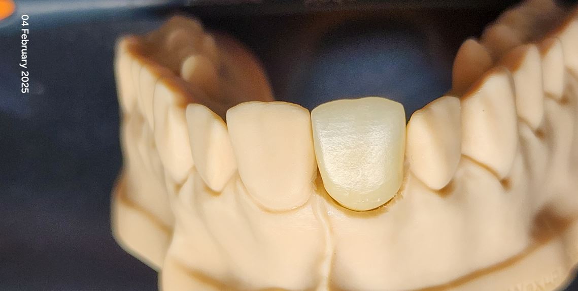 High translucent zirconia after sintering 