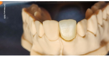 High translucent zirconia after sintering 